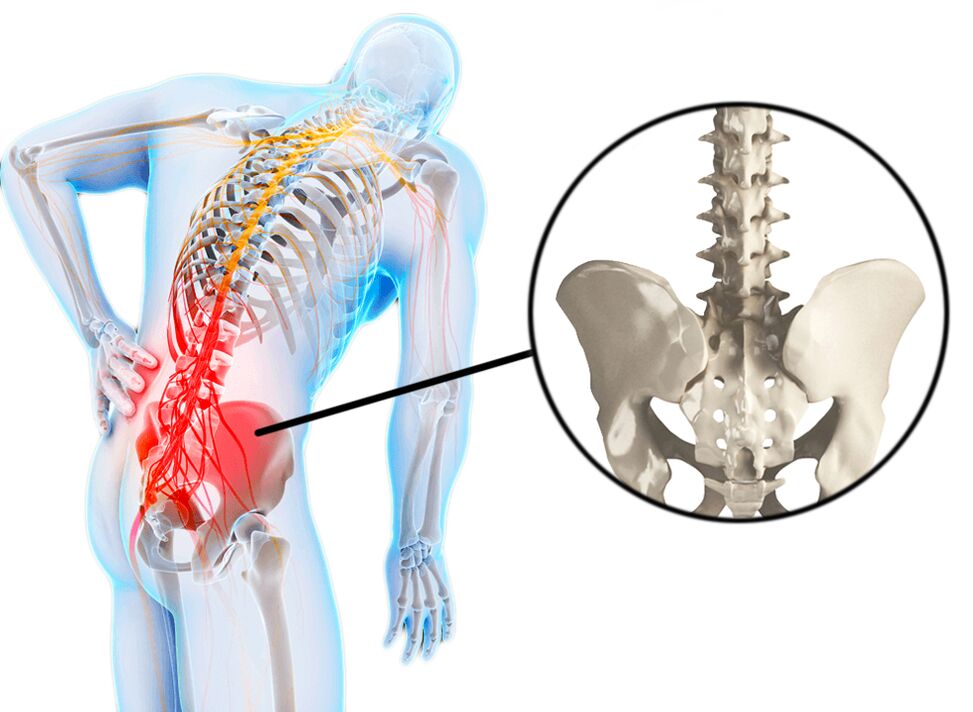 Patologie páteře jsou častou příčinou bolesti v bederní oblasti