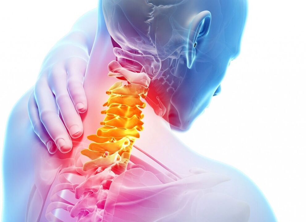 Co je krční osteochondrosis
