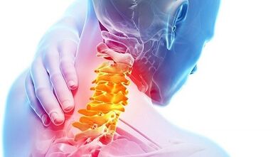 příčiny osteochondózy děložního čípku
