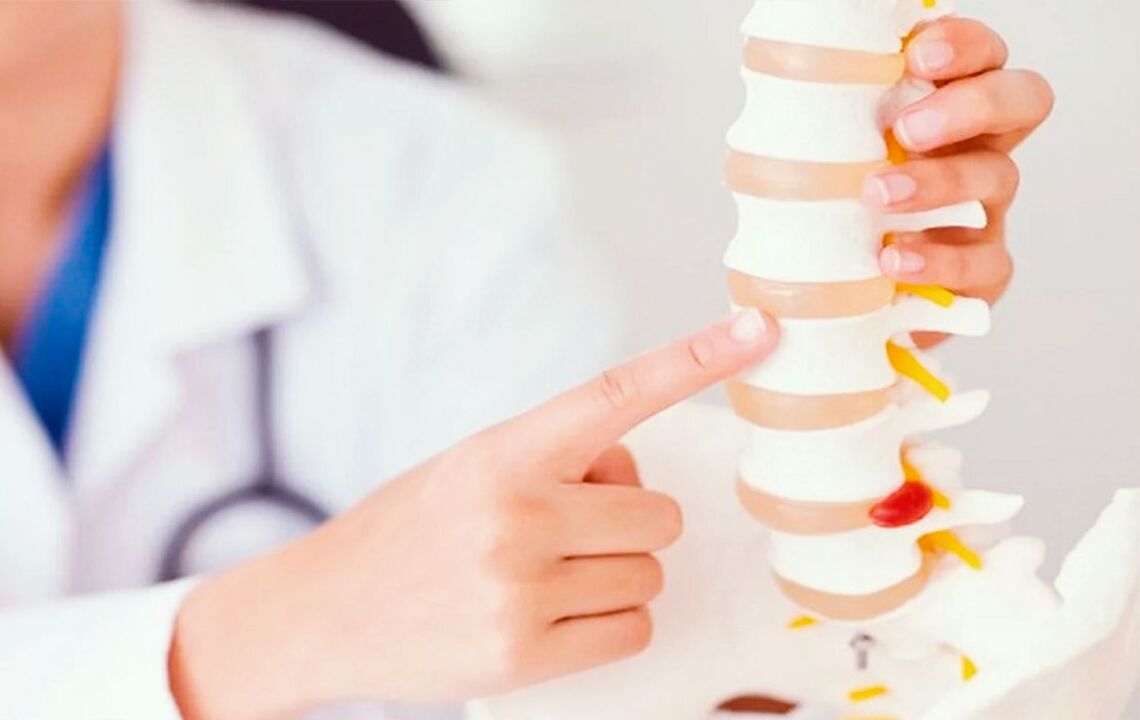 poškození páteře v důsledku cervikální osteochondrózy