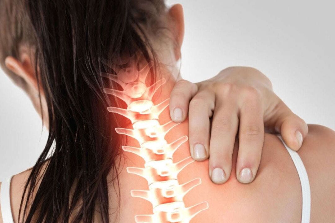 projevy děložní osteochondózy